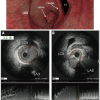 Figure 32